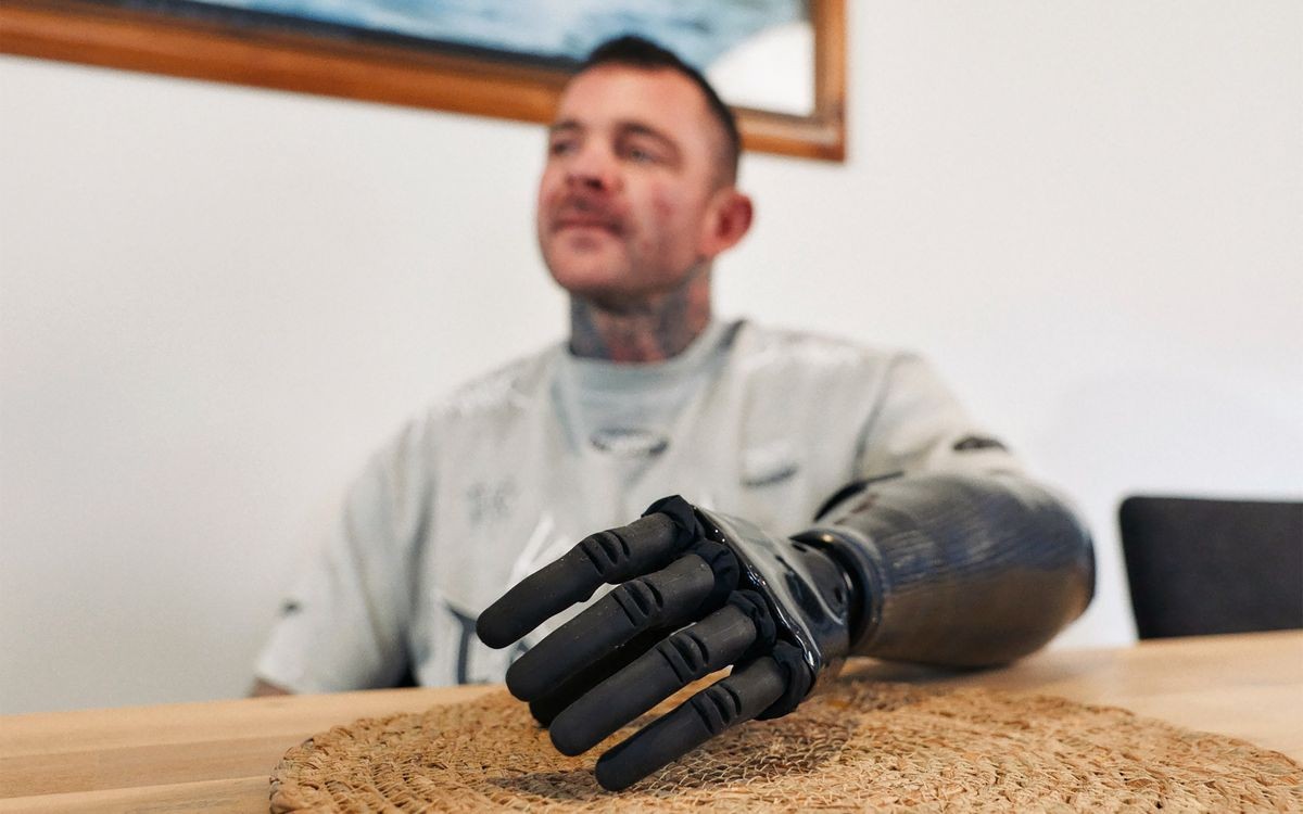 Carpinteiro consegue controlar braço robótico com os músculos após receber implante sob a pele - Foto