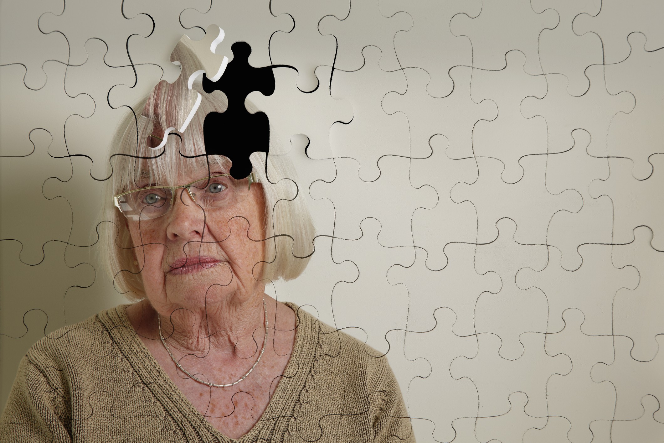 Pacientes com Alzheimer têm deficiência de um peptídeo chamado HAEE, diz estudo; saiba como descoberta pode levar a novo remédio contra a doença - Foto