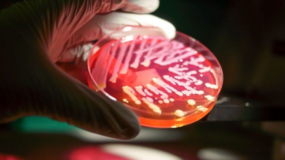 Nosso intestino abriga uma coleção de diferentes espécies de bactérias, e algumas delas aparentemente se comunicam com o nosso cérebro — Foto: RODOLFO PARULAN JR/GETTY IMAGES/VIA BBC