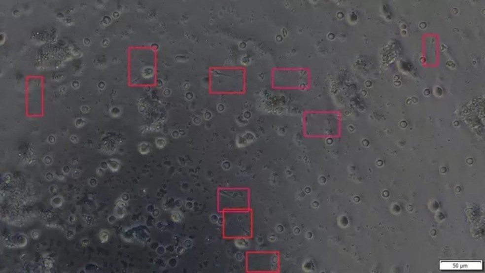 O sistema SpermSearch identifica rapidamente os espermatozoides e desenha um retângulo ao redor deles na tela — Foto: NEOGENIX BIOSCIENCES via BBC News