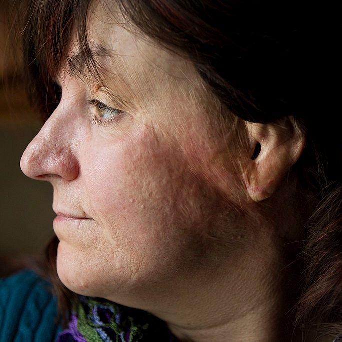 'Um incêndio mortal devastou a boate em apenas 90 segundos. Eu consegui sair'