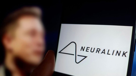 Neuralink sabe há anos que fios do seu dispositivo cerebral podem se soltar, mostra reportagem da Reuters