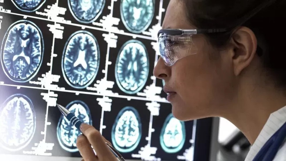 Primeiro exame de sangue que detecta o Alzheimer chega ao Brasil — Foto: Getty Images