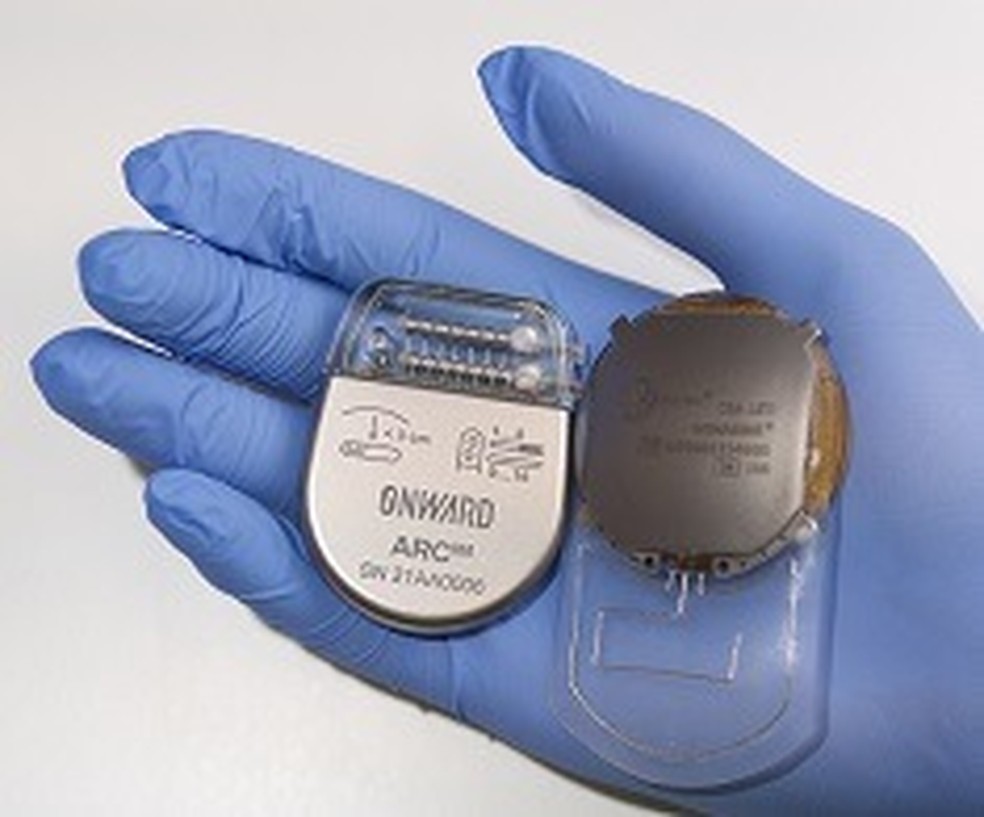 Implante Onward — Foto: Divulgação