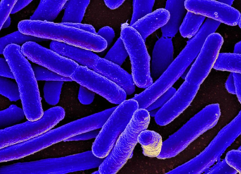 Cultura de bactéria E.coli — Foto: IMAGE POINT FR/NIH/NIAID/Universal Images Group via Getty Images