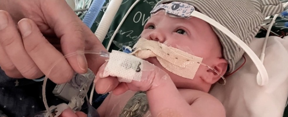 Owen Monroe, o primeiro bebê a receber um transplante parcial de coração — Foto: Duke Health