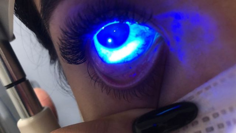 Mancha branca no olho de Adne revela lesão que ela teve — Foto: Arquivo Pessoal