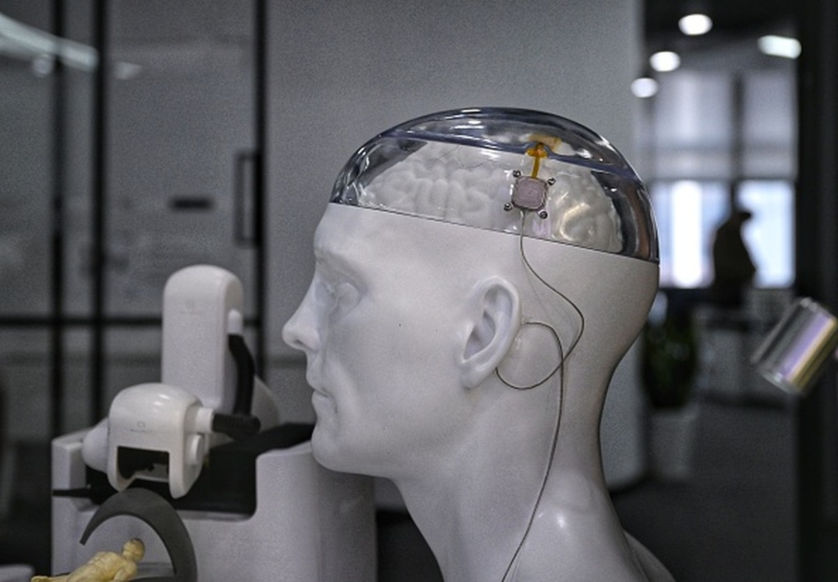 IMPLANTED MIND　エイハブ gettyimages-2200777369.jpg