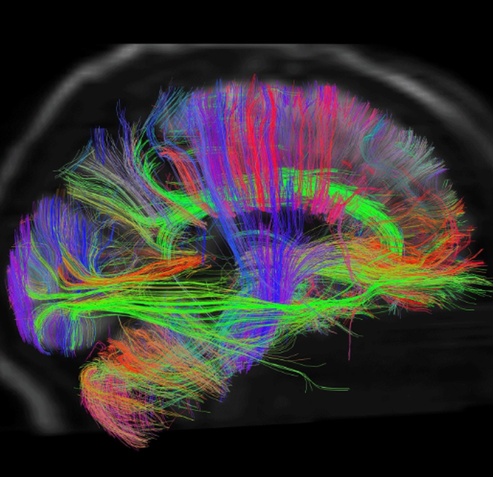 Pesquisadores estão estudando o cérebro na tentativa de compreender melhor a consciência. — Foto: BBC News fonte