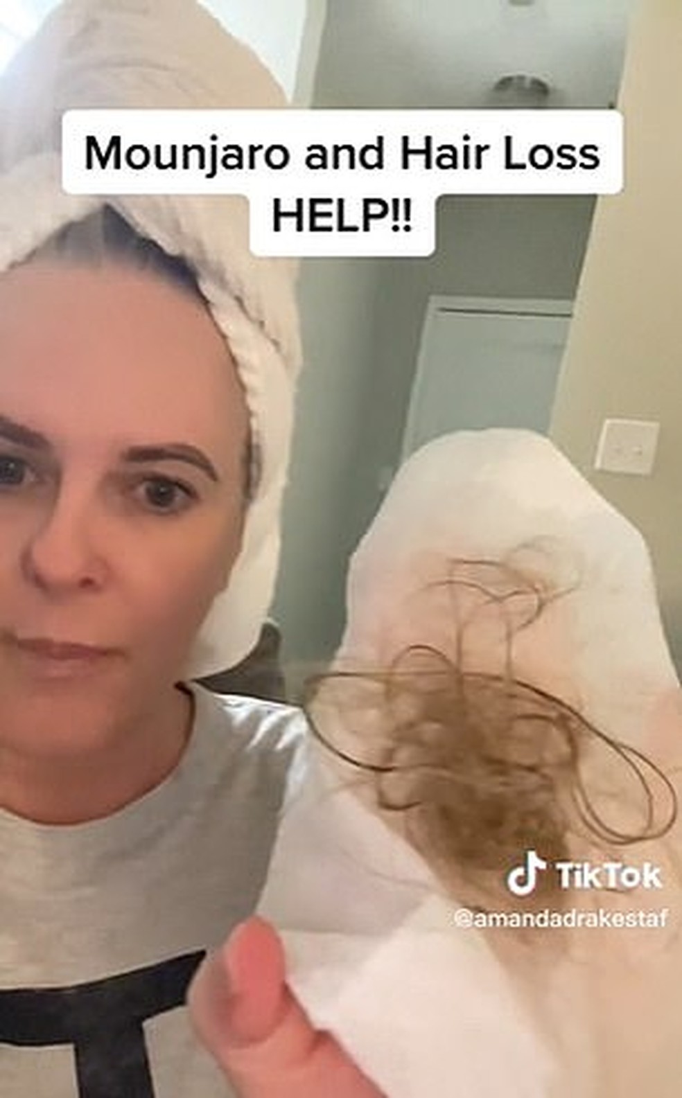 Amanda Staffor,  usuária do Mounjaro, mostra perda de cabelo com Mounjaro — Foto: Reprodução/Redes