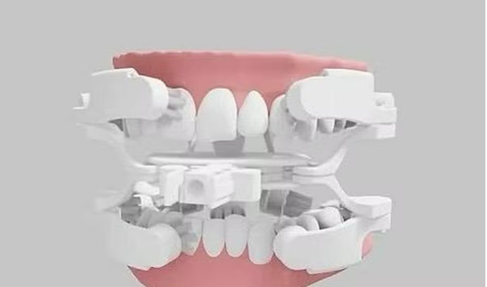 Tecnologia da escova de dente robótica — Foto: Divulgação/Genics