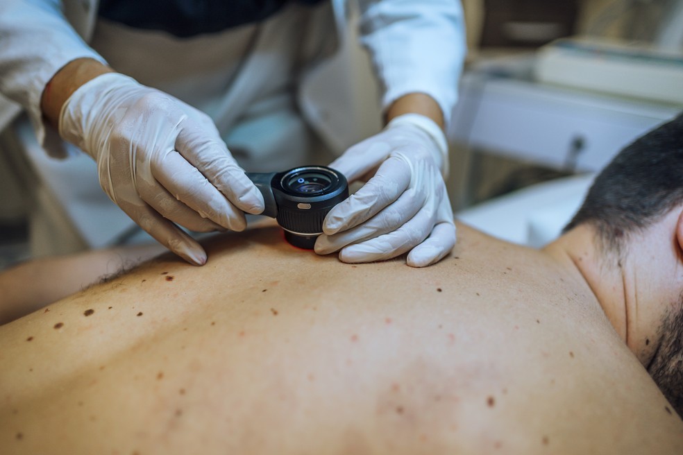 Tecnologia para tratar câncer de pele é aprovada para uso no SUS | Ciência  e Saúde | Época NEGÓCIOS