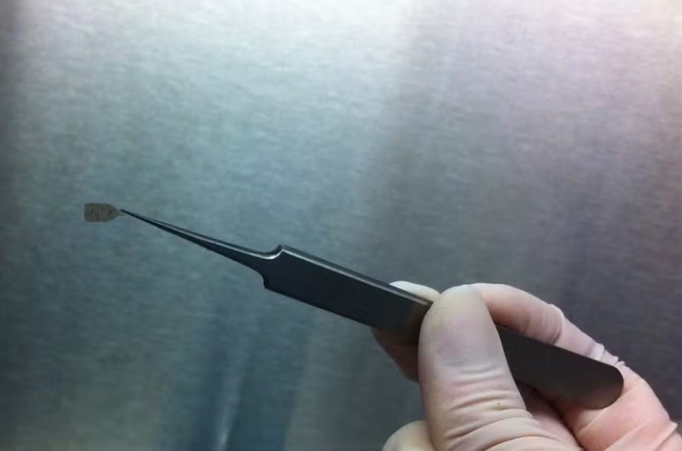 Cientistas testam microimplante ocular que pode ajudar a restaurar a visão — Foto: Reprodução: Keck Medicine USC