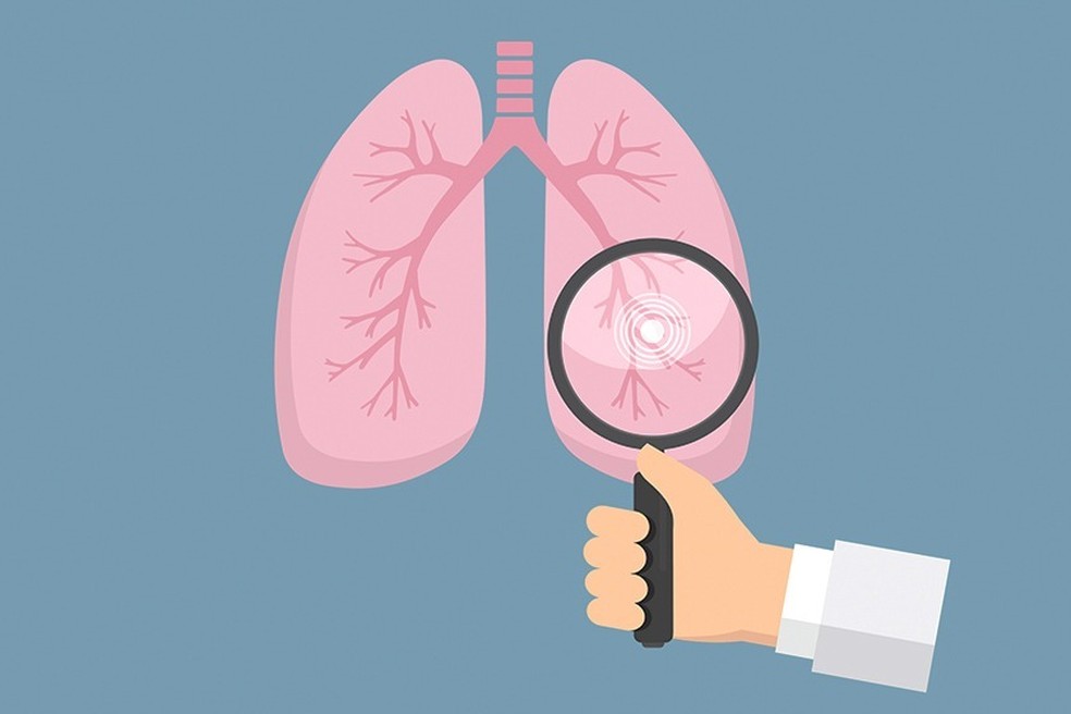  EndTB identificou três novas alternativas medicamentosas — Foto: Reprodução
