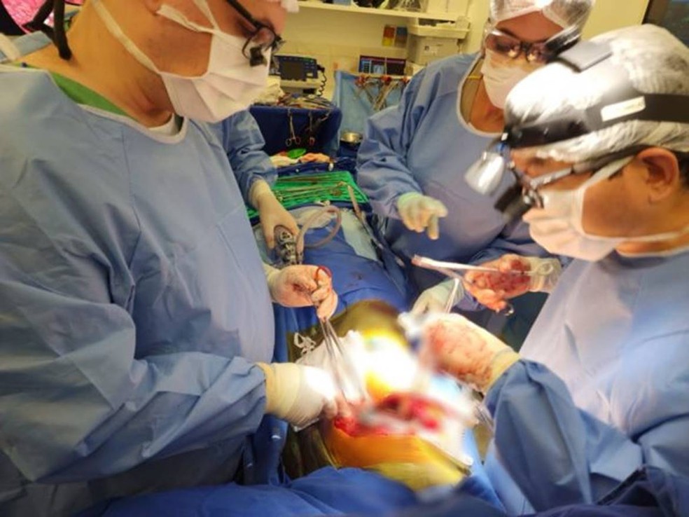 A equipe comandada por Samano durante a operação que retirou tumores do pulmão — Foto: DIVULGAÇÃO/MARCOS SAMANO via BBC