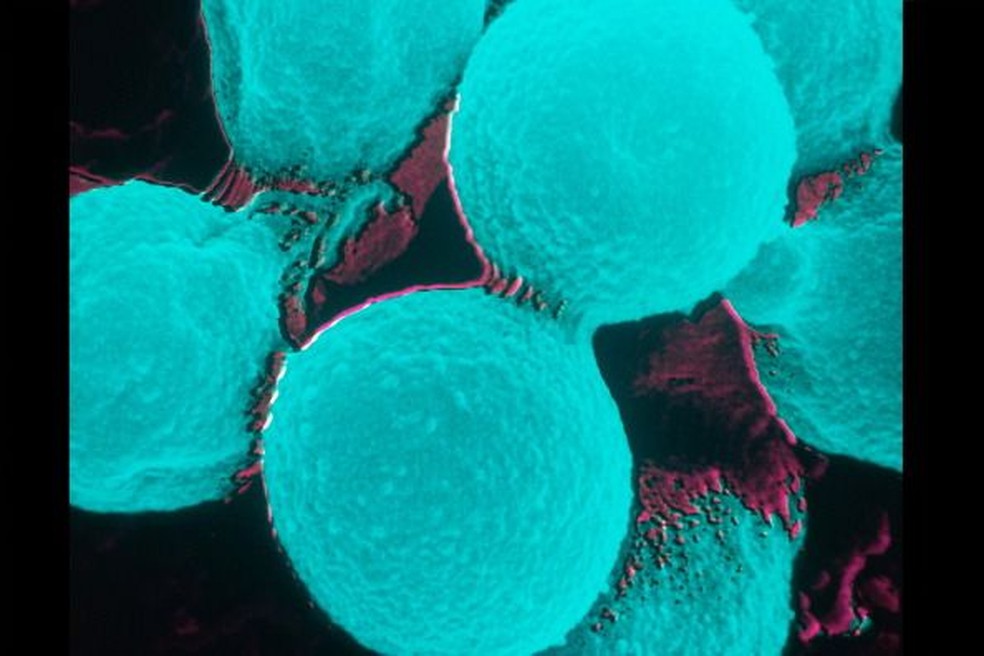O fungo Cryptococcus, que pode invadir o sistema nervoso dos seres humanos — Foto: GETTY IMAGES/VIA BBC