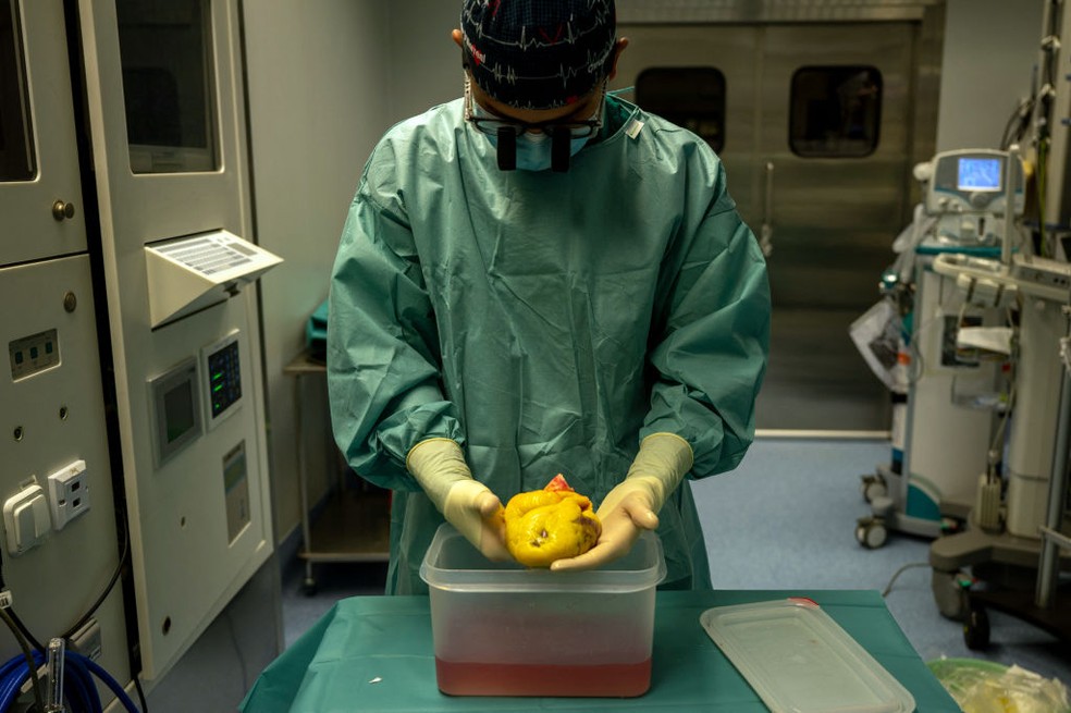 Transplante de coração — Foto: Javier Soriano/AFP via Getty Images