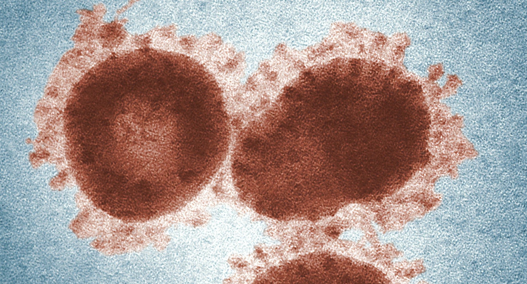 IA descobre como bloquear vírus da herpes antes de infectar células