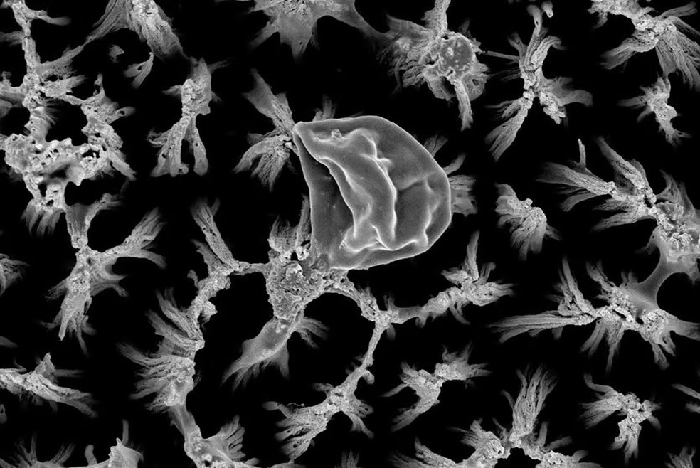 Espinhos semelhantes aos encontrados nas asas podem romper as células do fungo Candida, ampliadas nesta foto — Foto: RMIT University