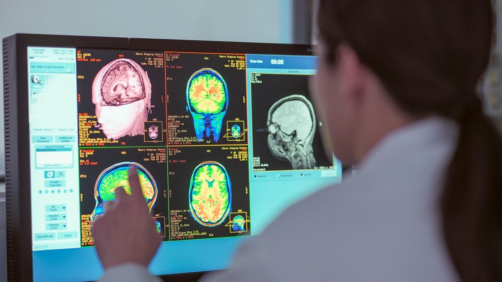 Pesquisadores identificaram cinco fases distintas no desenvolvimento do cérebro — Foto: BBC News fonte