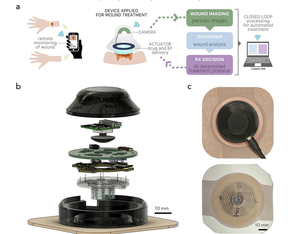 Esquema explica funcionamento do curativo inteligente:a. o micro dispositivo é colocado em um curativo, que é aplicado na ferida e passa a monitorar e liberar medicamentos; b.o aparelho em detalhes,mostrando a câmera integrada e mecanismo de liberação de medicamentos. c. imagens do dispositivo acomplado à bandagem — Foto: Reprodução