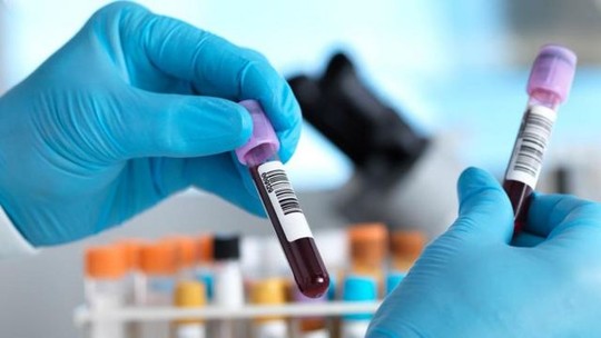 O exame de sangue em teste no Reino Unido que identifica mais de 50 tipos de câncer