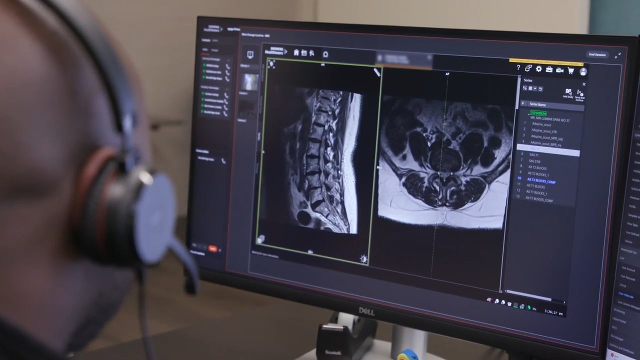 Como uma tecnologia criada no Brasil para operar ressonâncias à distância virou produto global da Siemens Healthineers
