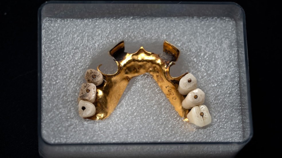 Dentaduras de ouro do século 19 — Foto: BBC News fonte