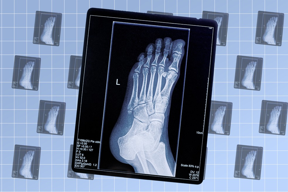 Raio-x — Foto: Arte EN