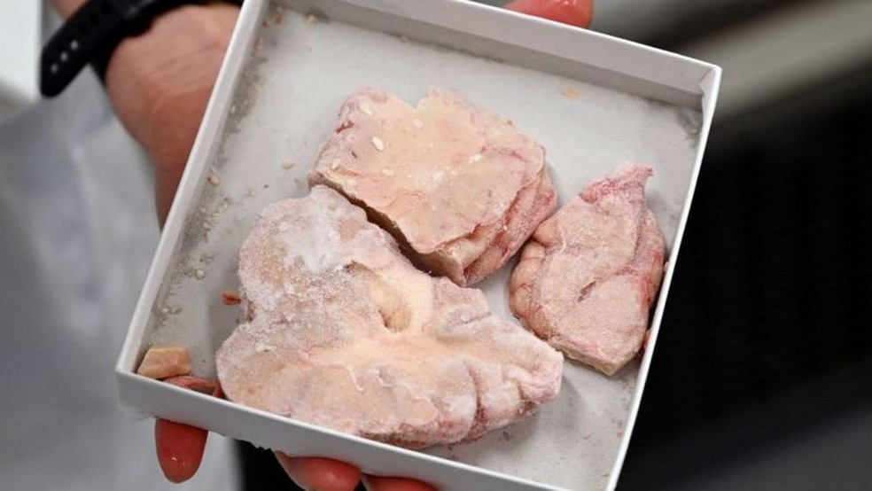 Cérebros e outros tecidos coletados durante as autópsias estão disponíveis para os pesquisadores — Foto: Getty Images via BBC